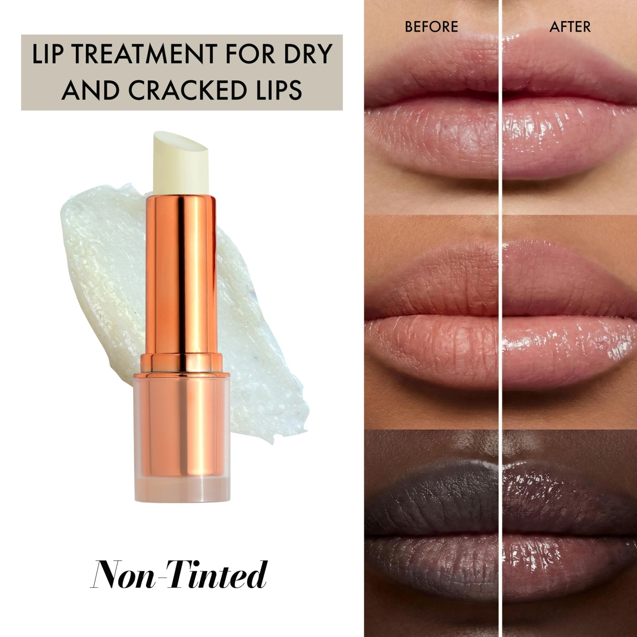 Clinexil Lip Balm – Hydrating Lip Repair with Cold-Pressed Oils, 10% Squalane, Vitamin E & Ceramides - TrustMedUSA