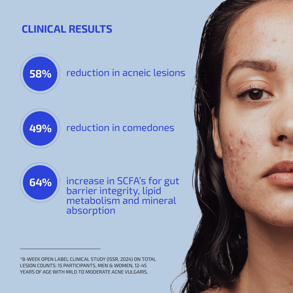 Codex Labs Shaant Clear Skin Supplement – 60 Vegan Capsules | Acne Probiotics with 9-Strain Blend, Green Tea EGCG & Guggul – Daily Support for Acne-Prone Skin & Clear Complexion - TrustMedUSA