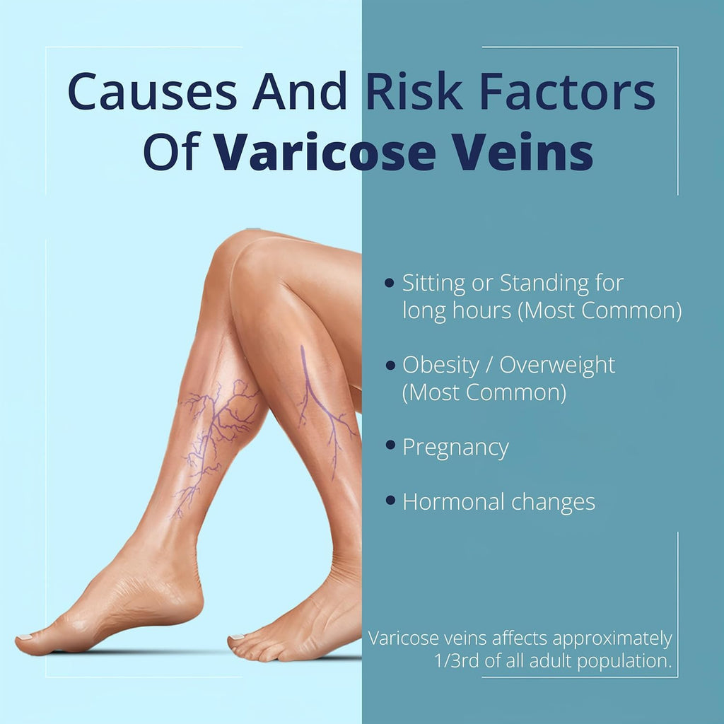 Cream Ayurvedic Solution for Management of Varicose Veins, Spider Veins, Varicocele Helps Reach The Root Cause of varicose Veins Reduces Cramps, Itching & Swelling. Single Tube (25 GMS). - TrustMedUSA