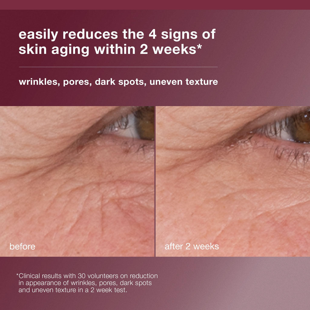 Dermalogica Dynamic Skin Retinol Facial Serum with Multi-Retinoid Complex, Retexturizing and Improving Skin Health, 1 fl oz - Maple Wellness Supplements
