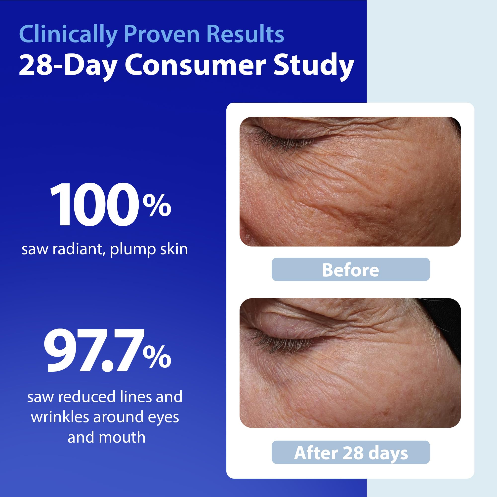 Dr. Denese SkinScience HydroShield Retinol Serum for Face 1 oz – Dermatologist Tested Hydrating Serum, Contains Retinol and Ceramides for Deep Moisture - Cruelty Free - Maple Wellness Supplements