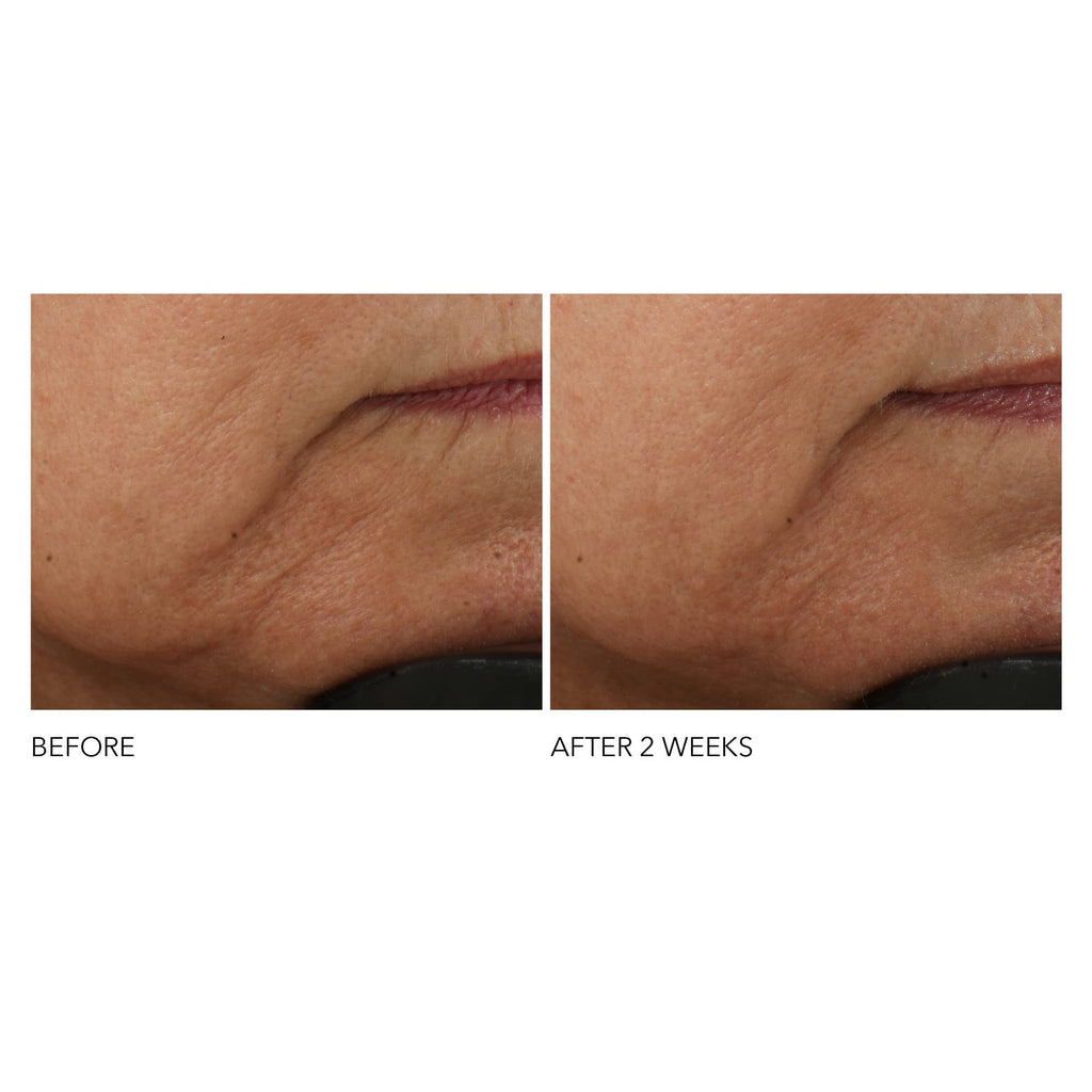Dr Dennis Gross Advanced Retinol + Ferulic Intense Wrinkle Cream | Intensely Hydrating to Visibly Transform Skin and Repair the Moisture Barrier | 2 oz - TrustMedUSA