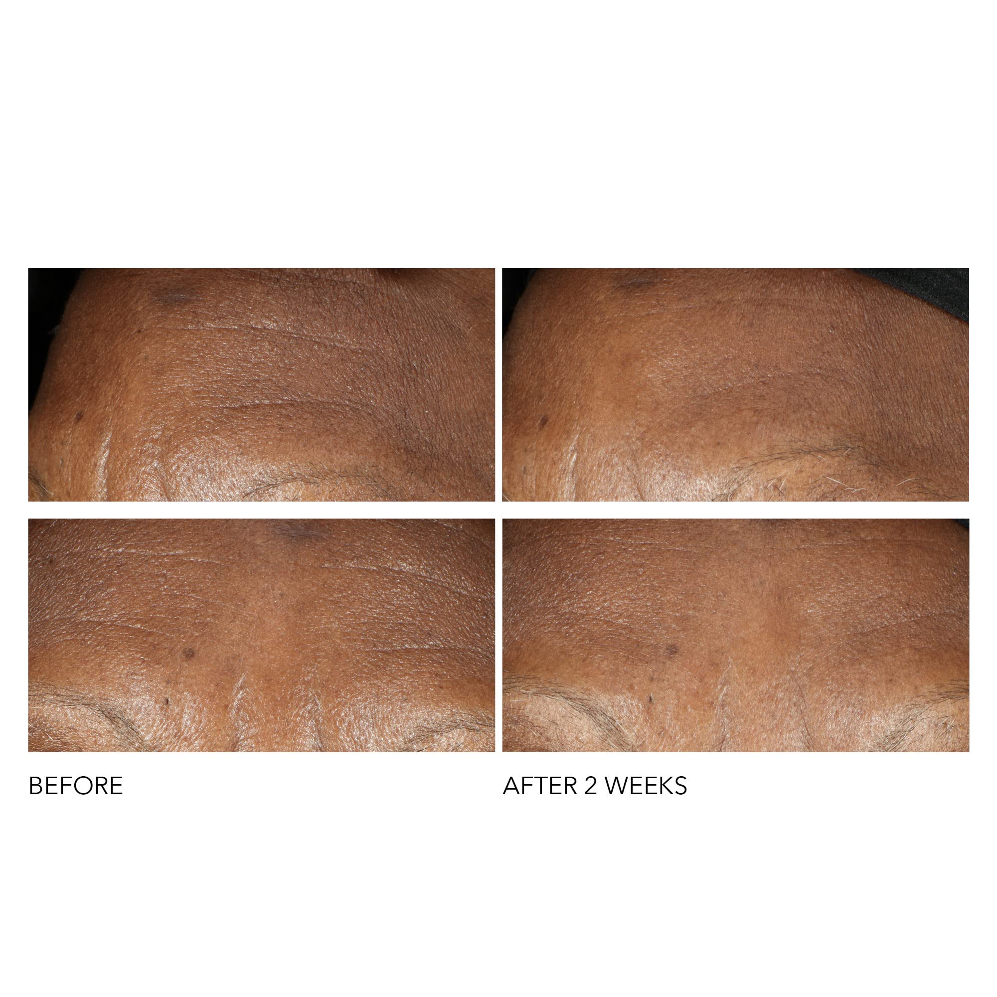 Dr Dennis Gross Advanced Retinol + Ferulic Intense Wrinkle Cream | Intensely Hydrating to Visibly Transform Skin and Repair the Moisture Barrier | 2 oz - TrustMedUSA