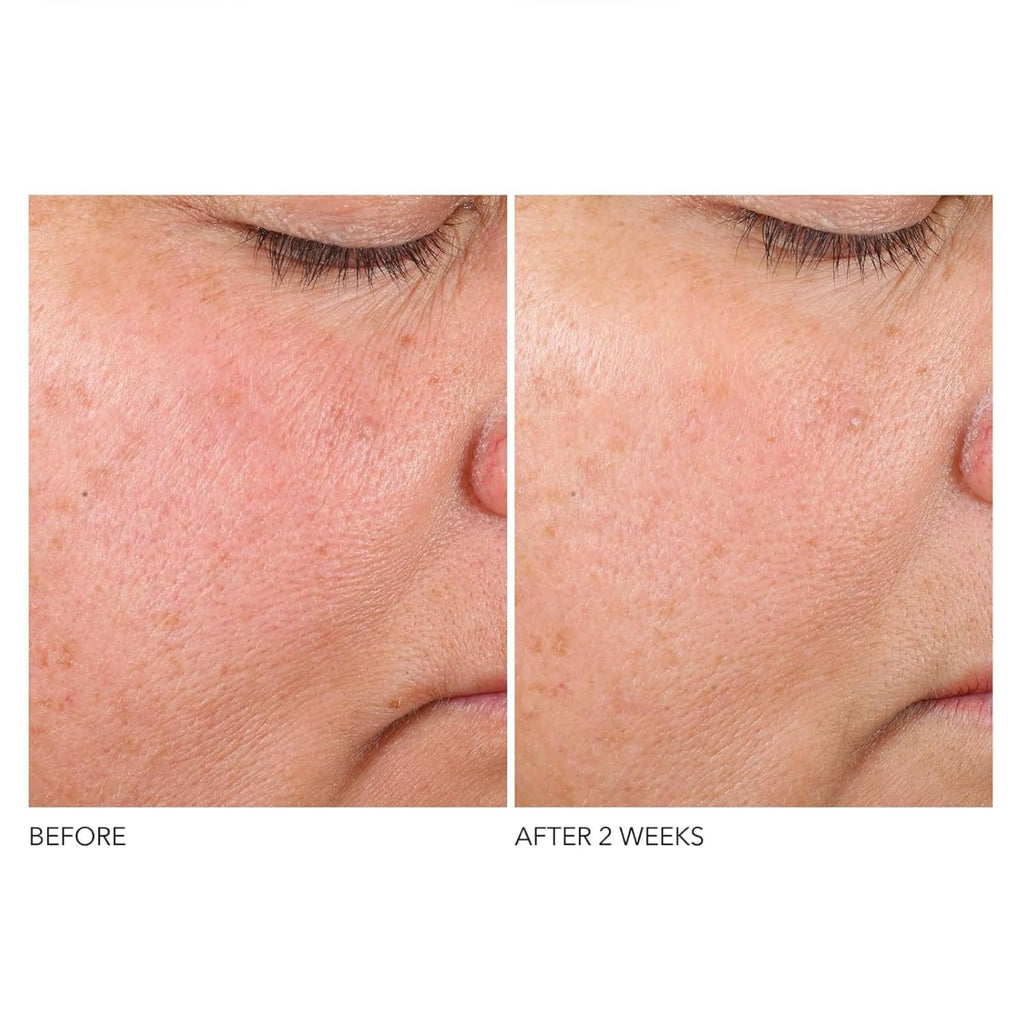 Dr. Dennis Gross Advanced Retinol + Ferulic Texture Renewal Serum – Anti-Aging Formula to Smooth Texture, Boost Radiance, and Minimize Fine Lines & Wrinkles, 1 oz - Maple Wellness Supplements
