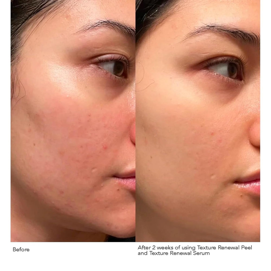 Dr. Dennis Gross Advanced Retinol + Ferulic Texture Renewal Serum – Anti-Aging Formula to Smooth Texture, Boost Radiance, and Minimize Fine Lines & Wrinkles, 1 oz - Maple Wellness Supplements