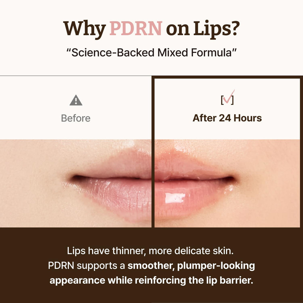 Dr. Reju-All Advanced PDRN Rejuvenating Lip Serum – Hydrating Lip Balm with Lipozip PDRN for Glowy, Dewy Lips - TrustMedUSA