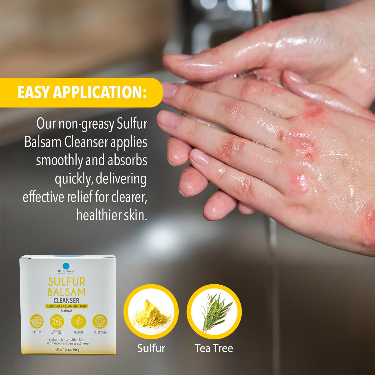 Dr. Robaina Sulfur Balsam Cleansing Bar – Face & Body Soap for Oily, Acne-Prone or Itchy Skin – Gently Exfoliates, Calms Redness & Removes Excess Oil – Tea Tree, Calendula & Shea, 4 oz - Maple Wellness Supplements