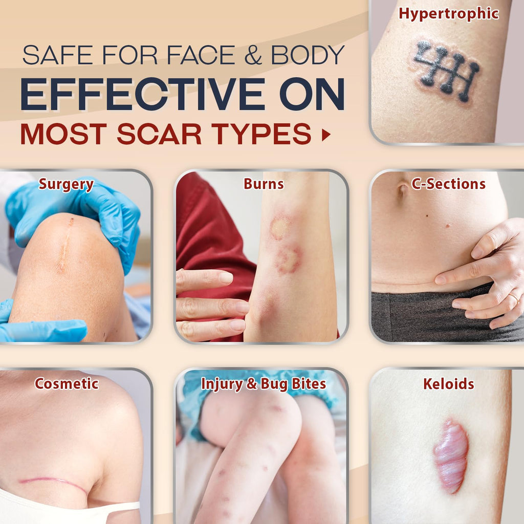 Ebanel Silicone Scar Gel with Allantoin, Emu Oil, Vitamin E and Onion Extract, For Old & New Scars from Surgeries, C-Section, Injuries, Burns & More - Maple Wellness Supplements
