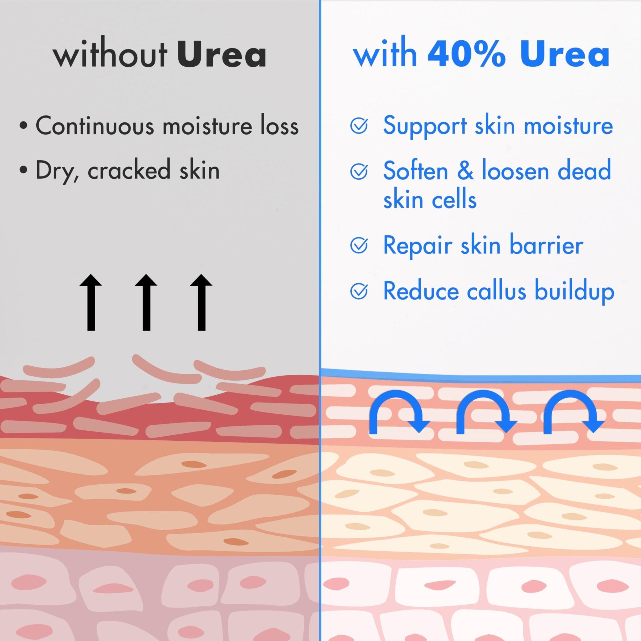 Ebanel Urea Cream 40% plus Salicylic Acid 2%, Foot Cream for Dry Cracked Heels Feet Knees Elbows Hands, Foot Dead Skin Cuticle Callus Remover Toenail Softener, Keratolytic Skin Barrier Repair, 2-Pack - Maple Wellness Supplements