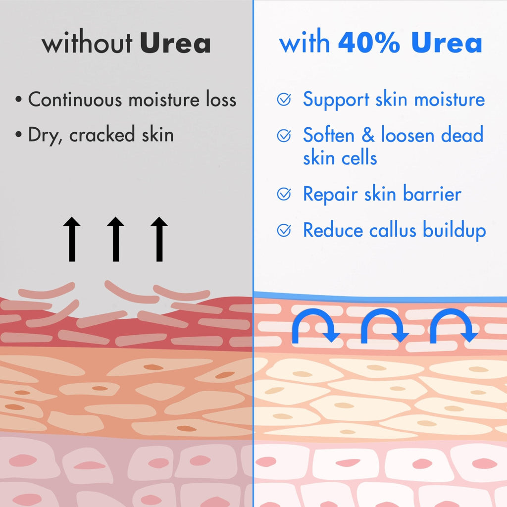 Ebanel Urea Cream 40% plus Salicylic Acid 2%, Foot Cream for Dry Cracked Heels Feet Knees Elbows Hands, Foot Dead Skin Cuticle Callus Remover Toenail Softener, Keratolytic Skin Barrier Repair - Maple Wellness Supplements