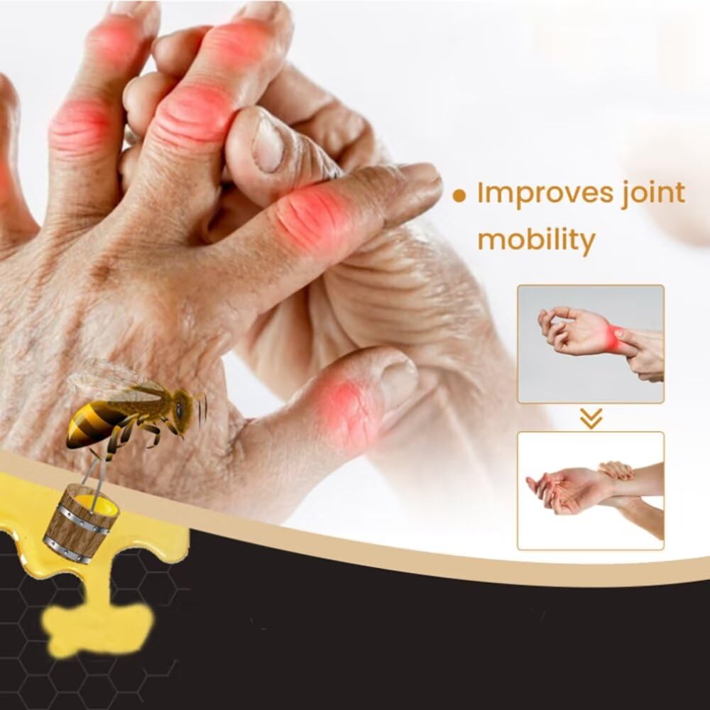 ETKOVNJ 6 Packs Bee Venom Cream, Bee Venom Bone Gel Joint Gel for Neck, Waist, Back of Hands, Feet and Legs - TrustMedUSA
