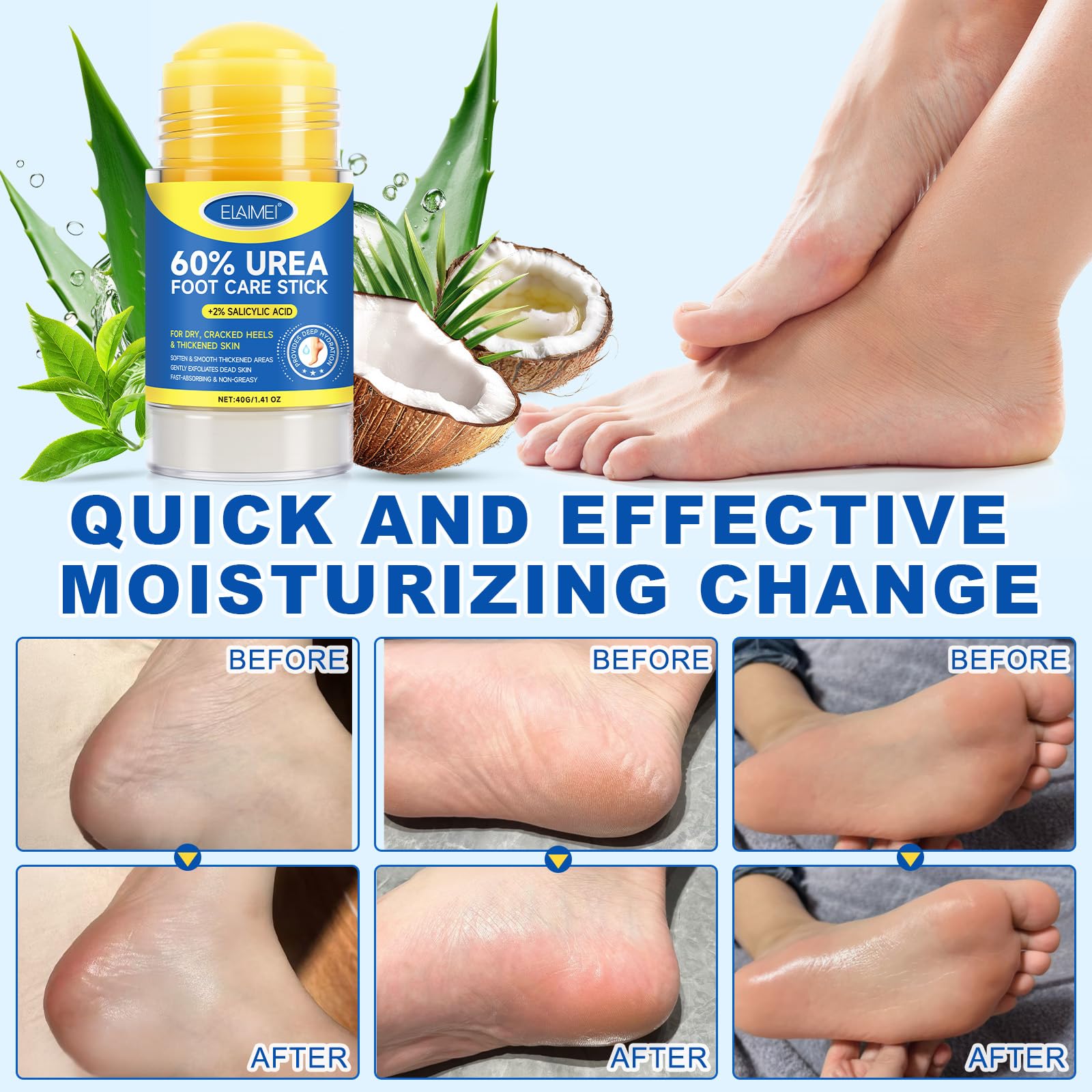 FANSHI 2 PCS Urea Stick 60% High Potency, Foot Care Urea Stick for Deeply Moisturizing & Fast Absorbing, Exfoliation for Dry Cracked Heels & Thickened Skin - Maple Wellness Supplements
