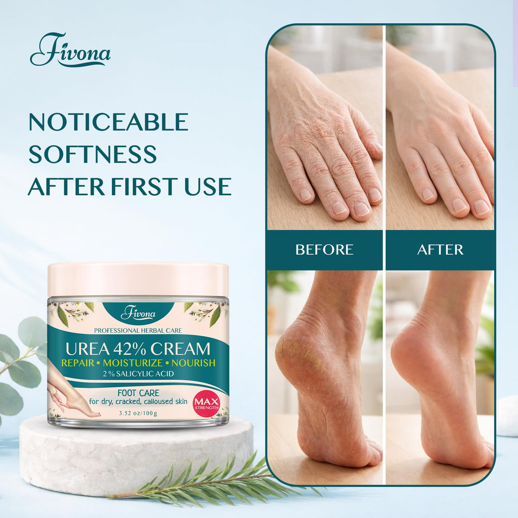 FIVONA 42% Urea Foot Cream for Thick, Rough Dry Skin - Maximum Strength Callus Softening with 2% Salicylic Acid, Tea Tree & Aloe Vera, 100g (3.5 oz) - Deep Moisturizing Foot Care - Maple Wellness Supplements