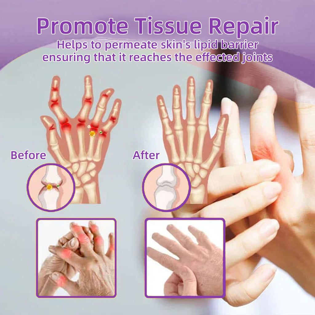 Flexbalm Rapid Joint Relief Therapy Gel 2.0, 2026 New Professional Relief Soothing Massage Gel, Flexbalm Rapid Joint Relief Cream for Back, Knee, Hands, Neck, Feet, for All Skin Types (2 Bottle) - TrustMedUSA