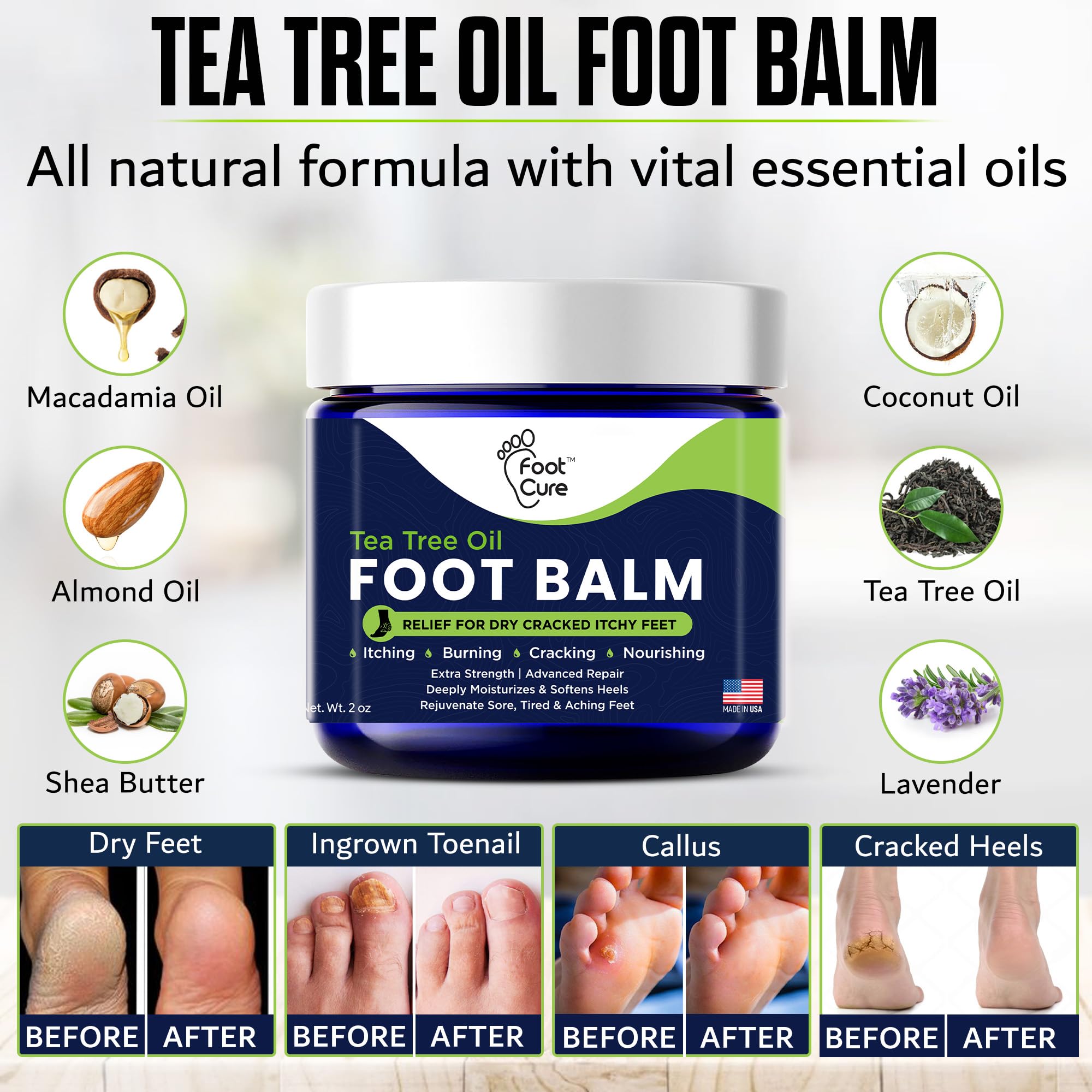 FOOT CURE Tea Tree Oil Balm – Moisturizer for Dry Cracked Feet – Instantly Hydrates & Soothes Irritated Skin & Athlete's Foot – Best Foot Care for Women and Men (Pack of 2) - Maple Wellness Supplements