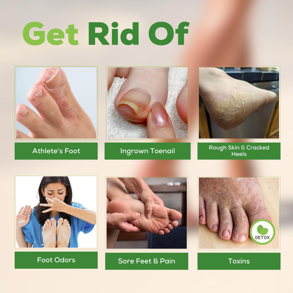 FOOT CURE Tea Tree Oil Foot Soak with Epsom Salt - Best Toenail Fungus Treatment, Athletes Foot & Softens Calluses - Soothes Sore & Tired Feet, Fungal Toe, Foot Odor Scent, Spa Pedicure (Pack of 2) - Maple Wellness Supplements