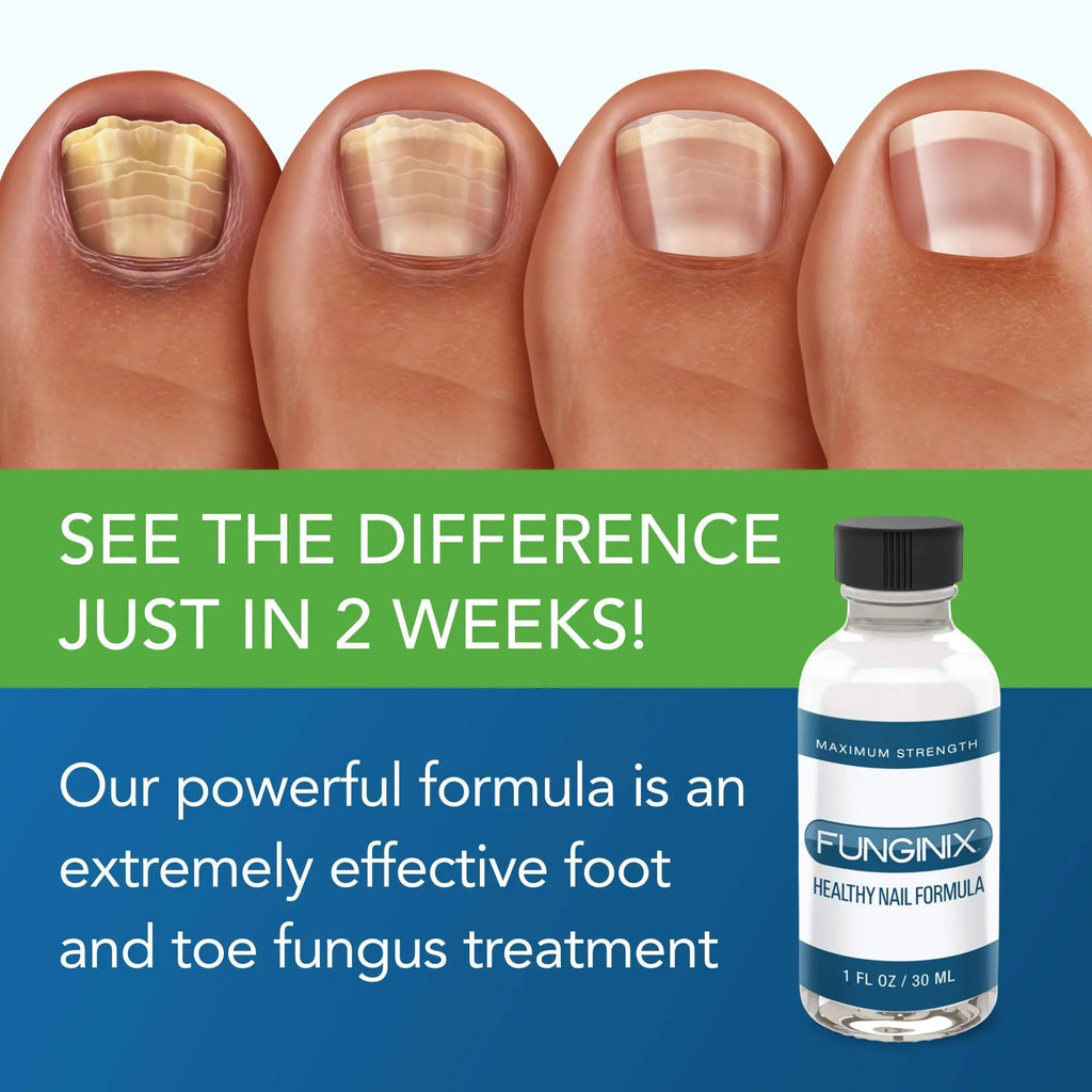 FUNGINIX Healthy Nail Formula - Finger And Toe Fungus Treatment, Made In USA, Foot - TrustMedUSA