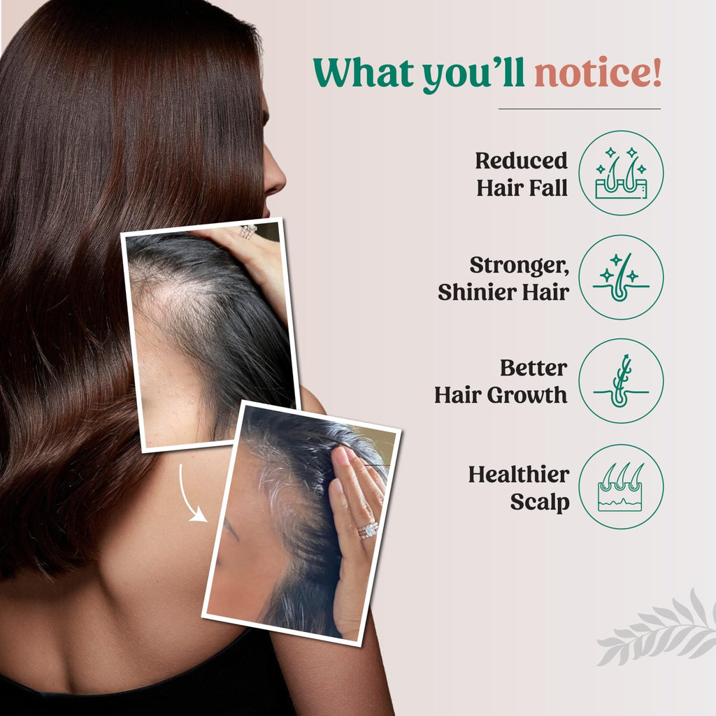 Glosense Hair You Glo – Plant-Based Biotin Supplement | Hair Growth Drink | Natural Hair Vitamins Powder with Amla, Sea Buckthorn, Gotu Kola | No Added Sugar, No Added Flavours | 30 Servings - TrustMedUSA