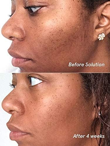 Glossier Solution exfoliating skin perfector 4.4 fl oz / 130 ml - TrustMedUSA