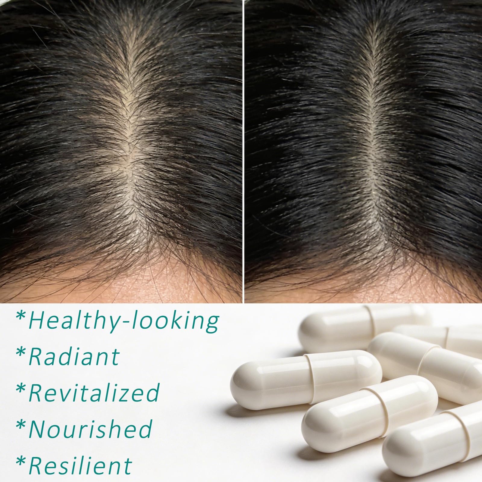 Hair Growth Biotin 10000mcg Supplement with Vitamins A C D E & Calcium - 30-in-1 Formula for Hair & Nails Support, for Women & Men, 30 Servings (1) - TrustMedUSA