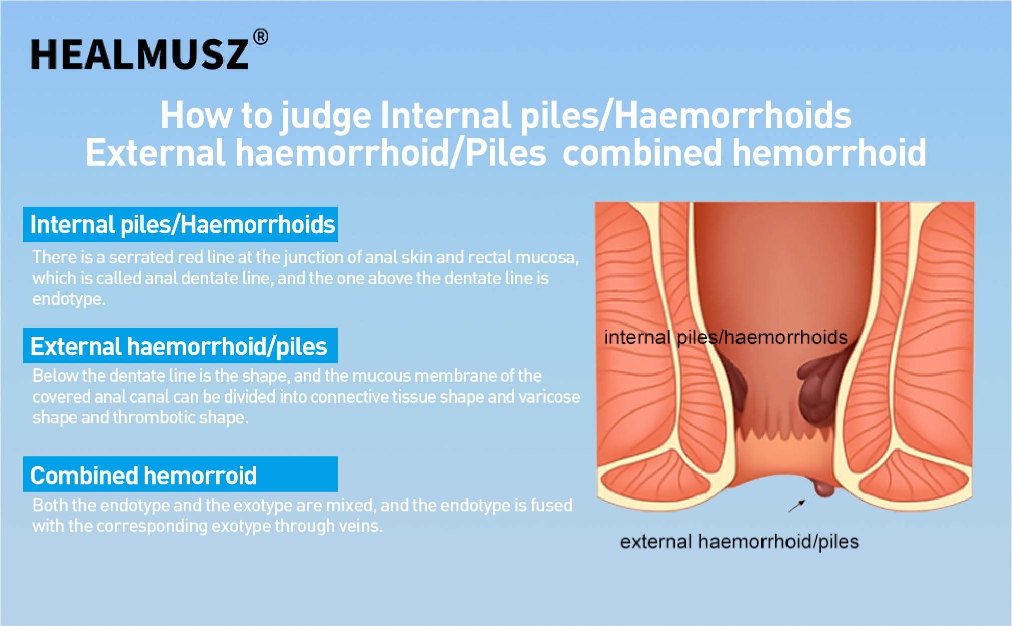 HEALMUSZ Hemorrhoid Fissure Ointment– Hemorrhoid Treatment and Hemorrhoid Cream with Lidocaine and Phenylephrine HCI for Fast Acting Relief of Pain, Swelling, Discomfort, and Itching(1.5 oz) - TrustMedUSA