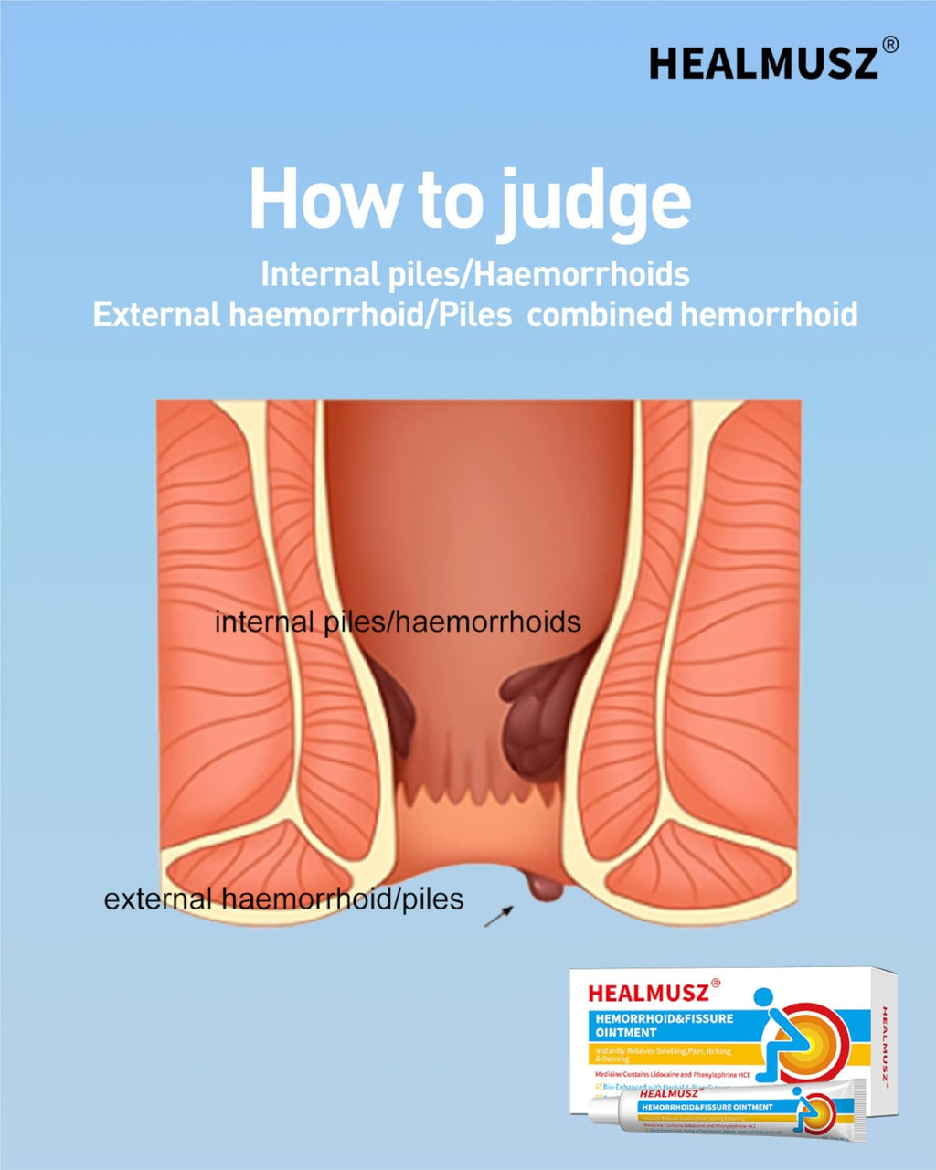 HEALMUSZ Hemorrhoid Fissure Ointment– Hemorrhoid Treatment and Hemorrhoid Cream with Lidocaine and Phenylephrine HCI for Fast Acting Relief of Pain, Swelling, Discomfort, and Itching(1.5 oz) - TrustMedUSA