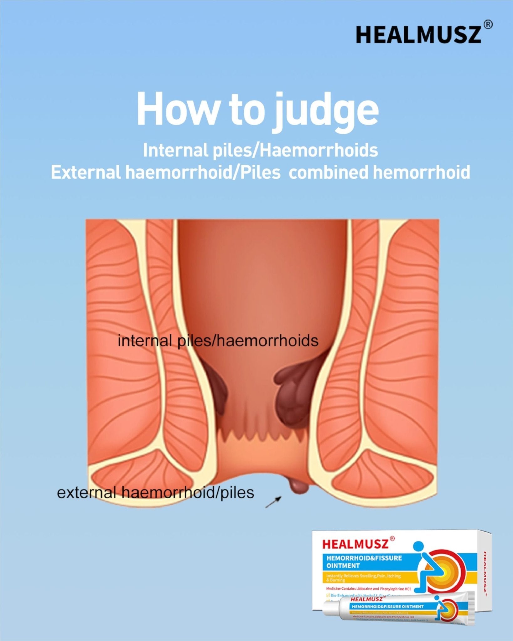 HEALMUSZ Hemorrhoid Fissure Ointment– Hemorrhoid Treatment and Hemorrhoid Cream with Lidocaine and Phenylephrine HCI for Fast Acting Relief of Pain, Swelling, Discomfort, and Itching(1.5 oz) - TrustMedUSA
