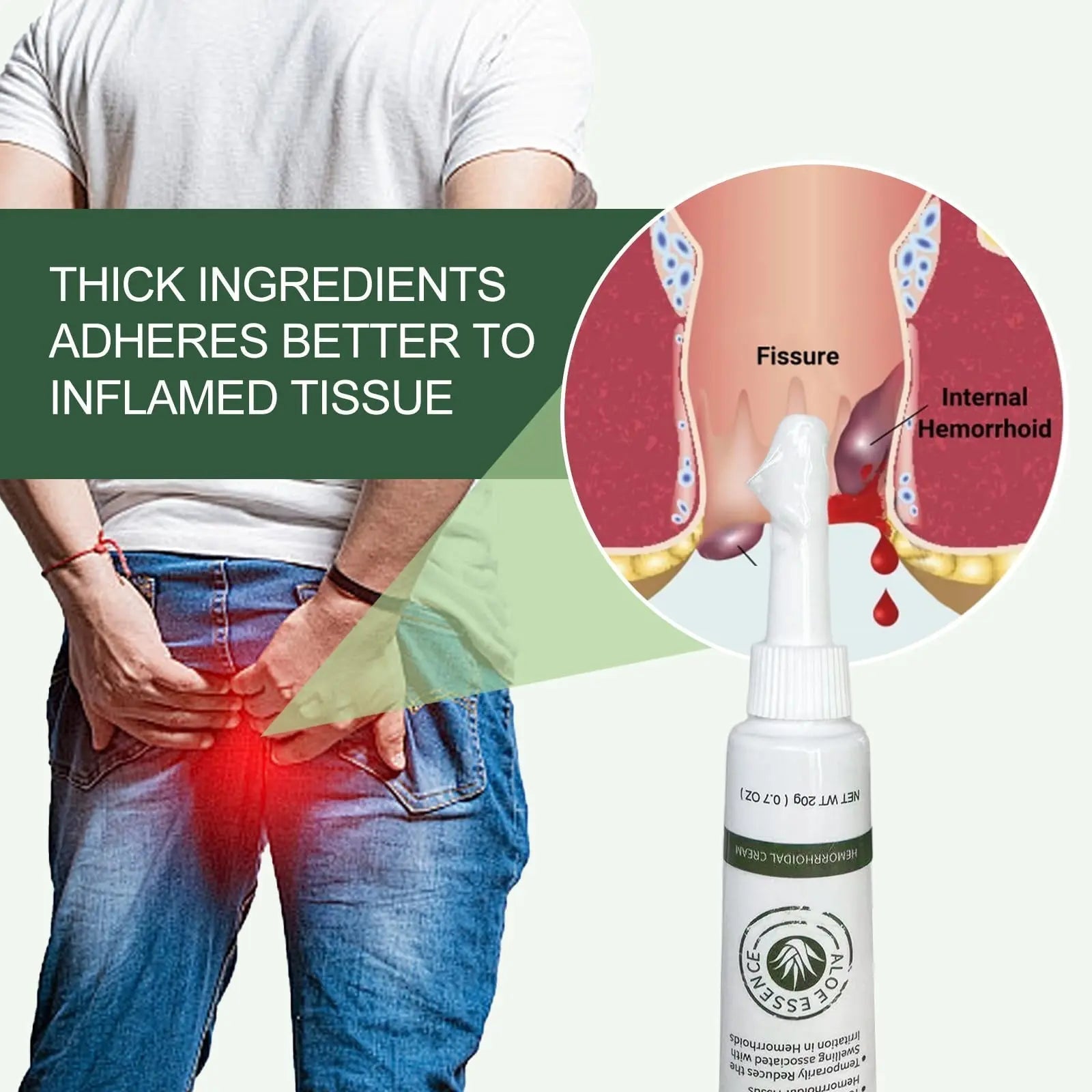 Hemorrhoid & Fissure Ointment, Hemorrhoid Treatment and Hemorrhoid Cream with Lidocaine 4% and Phenylephrine HCI for Fast Relief of Pain, Swelling, Itching, Burning, Hemorrhoidal treatment, 2 Pack-J2 - TrustMedUSA