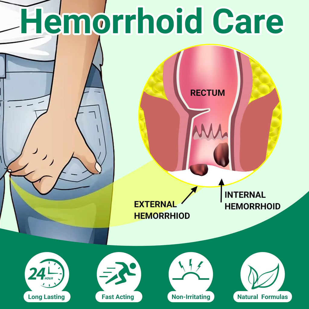 Hemorrhoid Treatment Ointment, Maximum Strength Treatment & Fast Relief for Pain, Itching, Burning, Swelling, Fissure, Bleeding, Discomfort, Long-Lasting Internal & External Hemorrhoid Cream, (2-Pack) - TrustMedUSA