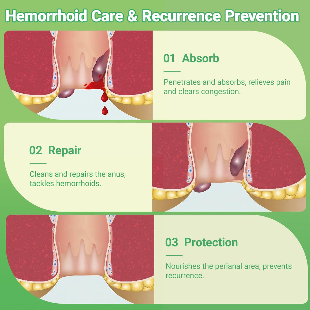 Hemorrhoid Treatment Ointment - Tubesmaximum Strength - Fast Relief from Pain, Itching, Burning, Swelling & Fissures | Natural Aloe & Vitamin E | Travel-Friendly10g x 5 Pieces Tubes - (1.76 Oz) - TrustMedUSA