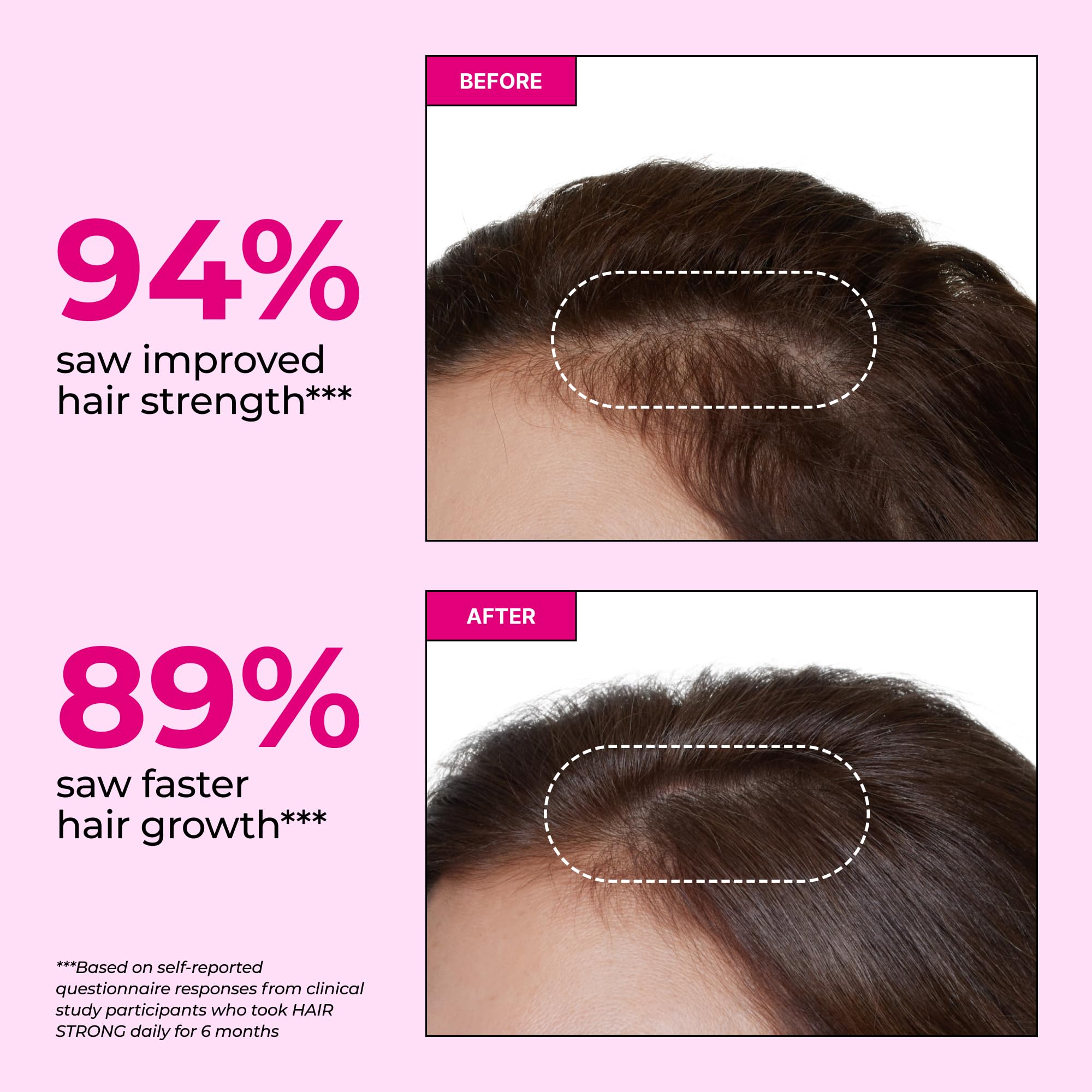 HUM Hair Strong Daily Hair Growth Gummies with Biotin, Zinc, Vitamin B12 to Support Growth, Folic Acid & Vitamin B12 Gummy Vitamins for Healthy Hair Support for Women and Men, 60 Gummies - TrustMedUSA