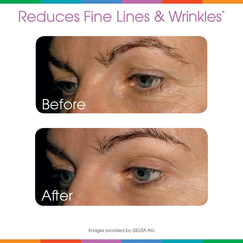 Hydrolyzed Collagen Powder - Sparkle Skin Boost Plus (Tropical Coconut Pineapple) - TrustMedUSA
