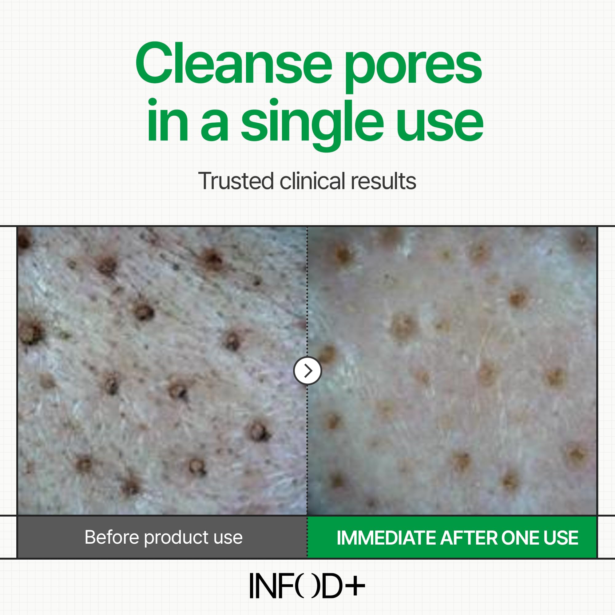 INFODPLUS Gel Cleanser, Gentle Low pH Deep Cleansing, Oil Control, Pore Blackhead Removal Face Wash, Ceramide Panthenol, Hydrating Barrier Balance Korean Skincare for Sensitive Skin, 3.38 fl.oz 100ml - Maple Wellness Supplements