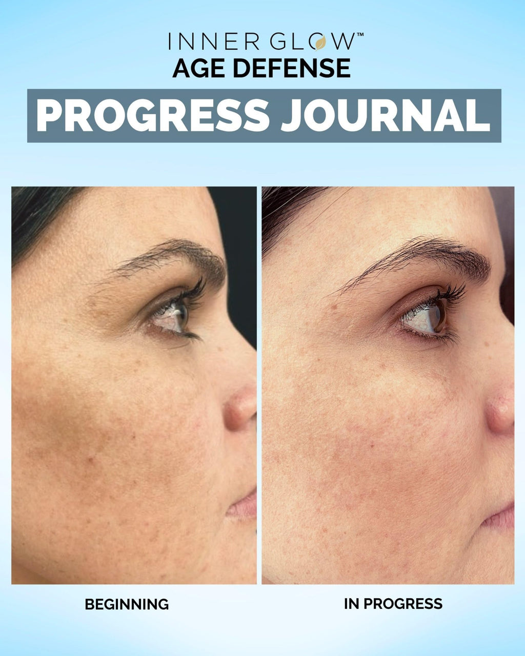 Inner Glow Age Defense Vitamins - Dermatologist and Plastic Surgeon Developed to Fight photoaging and Melasma, Polypodium Leucotomos Antioxidant Formula – Vegan, Gluten-Free – 60 Capsules - TrustMedUSA