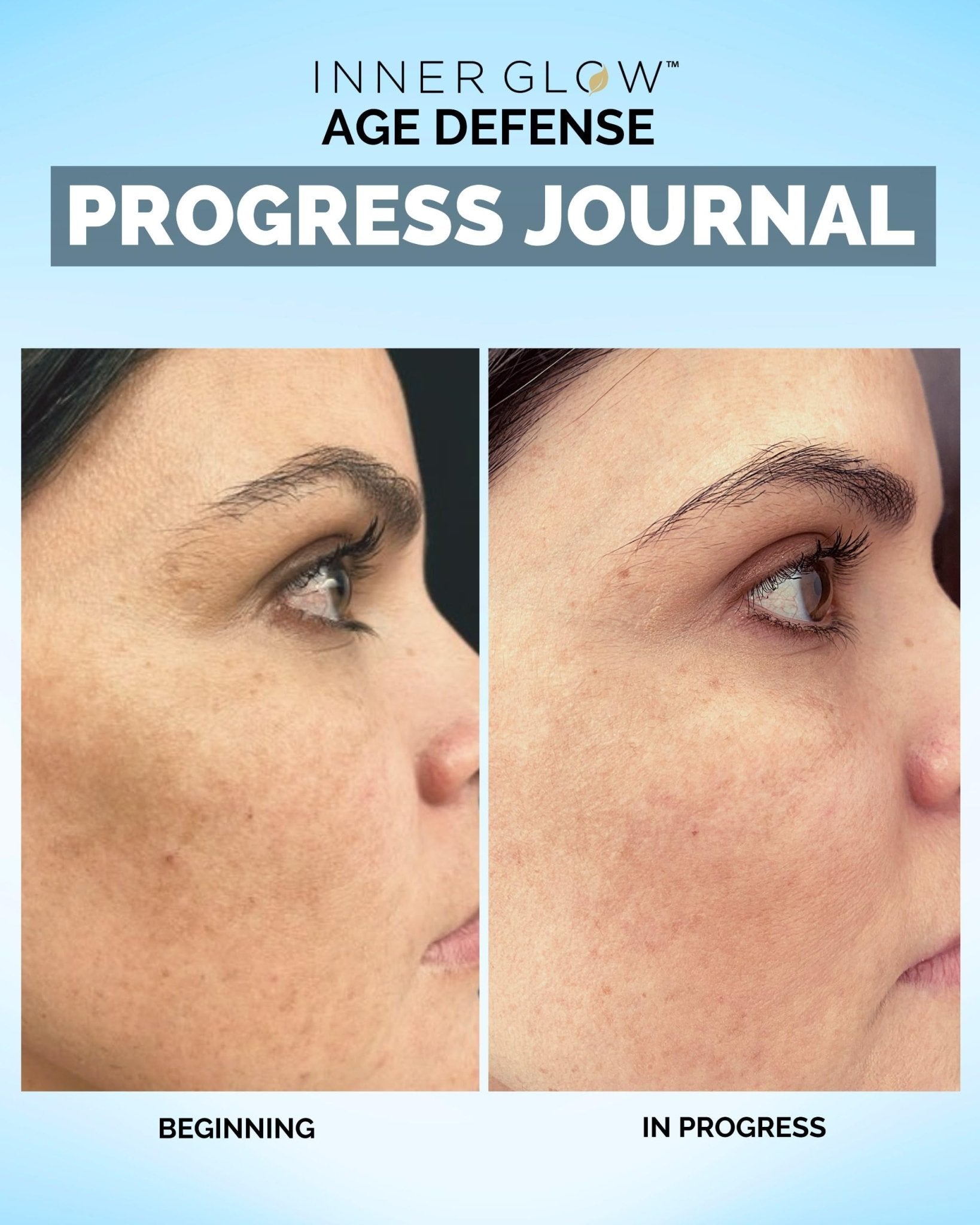 Inner Glow Age Defense Vitamins - Dermatologist and Plastic Surgeon Developed to Fight photoaging and Melasma, Polypodium Leucotomos Antioxidant Formula – Vegan, Gluten-Free – 60 Capsules - TrustMedUSA
