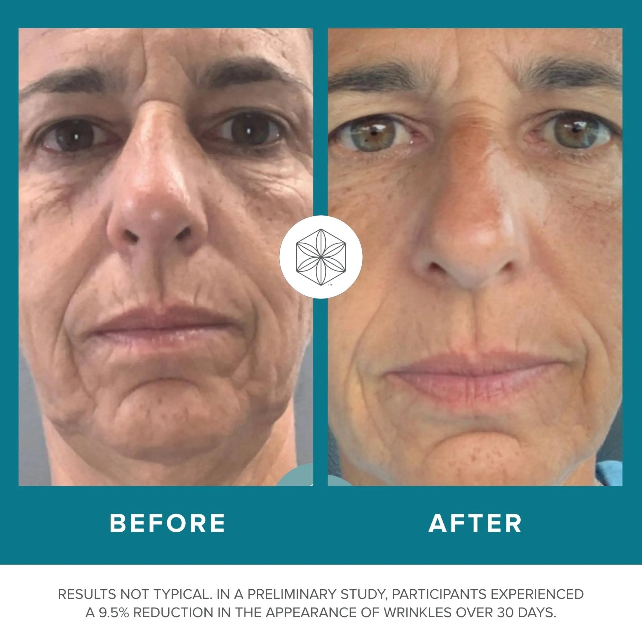 Isagenix Collagen Elixir - Collagen Drink with Marine Collagen Peptides - Liquid Collagen - TrustMedUSA