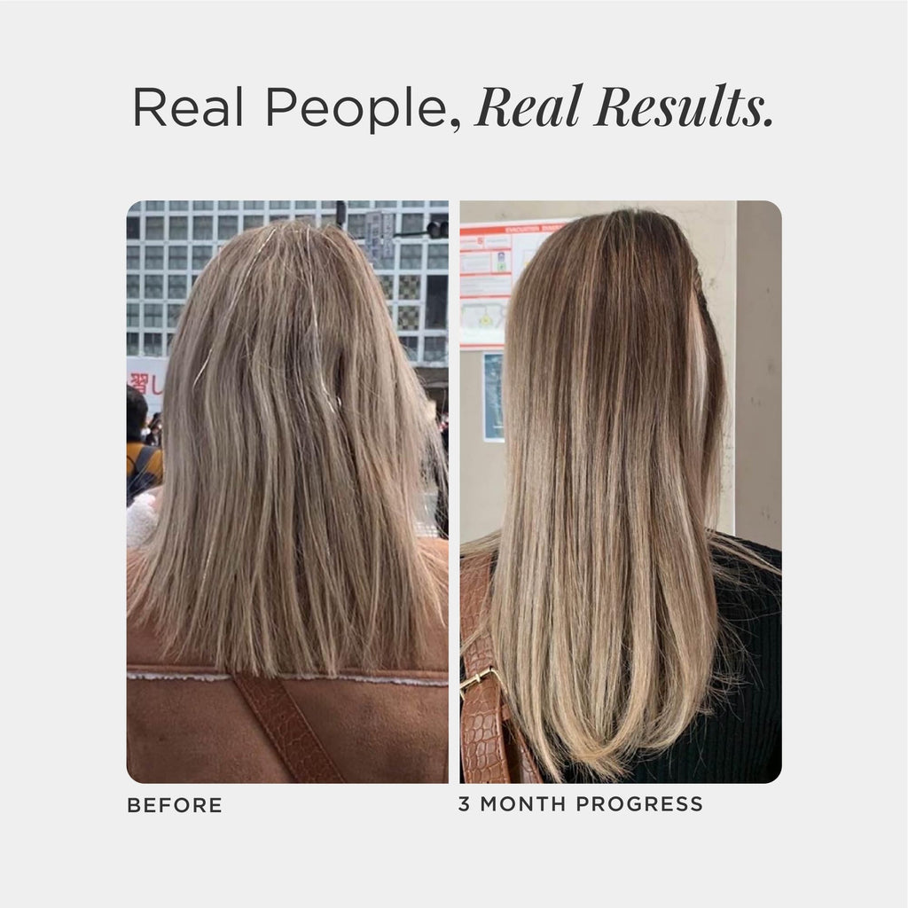 JSHealth Hair Growth Vitamins for Women. Hair + Energy with Kelp Iodine and Zinc. Supports Thickness, Strength, Energy. Nutritionist-Formulated (60 Capsules) - TrustMedUSA
