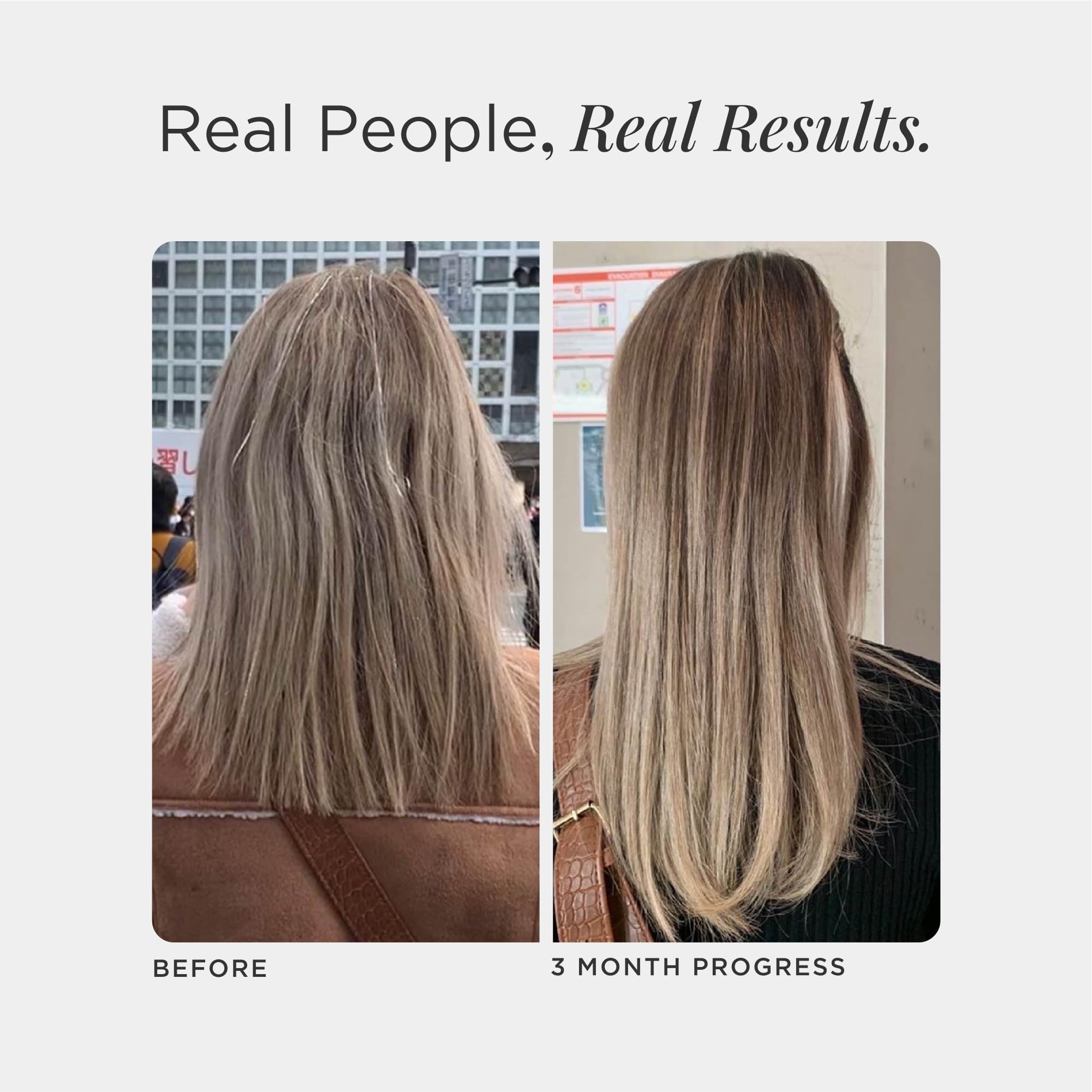 JSHealth Hair Growth Vitamins for Women. Hair + Energy with Kelp Iodine and Zinc. Supports Thickness, Strength, Energy. Nutritionist-Formulated (60 Capsules) - TrustMedUSA