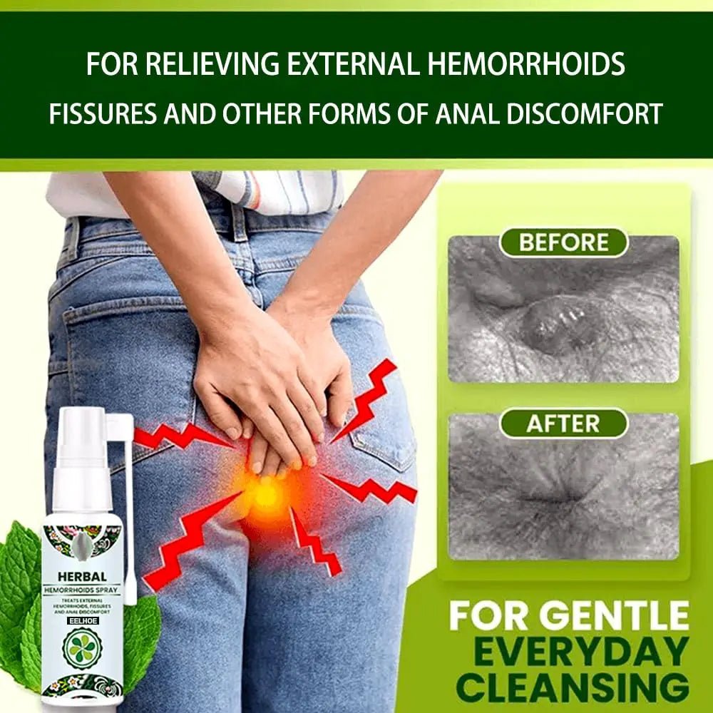 Juztec Hemorrhoid Treatment - Fast Relief with Hemocare Herbal Hemorrhoids Spray & Analese Numb Cream (1 PCS) - TrustMedUSA