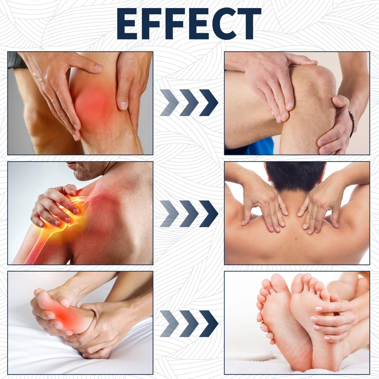 Kubot 2PCS Neuropathy Relief Cream | Contains Capsaicin, Arnica, Menthol and Glucosamine, Suitable for Feet, Hands, Legs, Muscles, Joints, and Waist, Fast Absorption, Mild & All Natural - TrustMedUSA