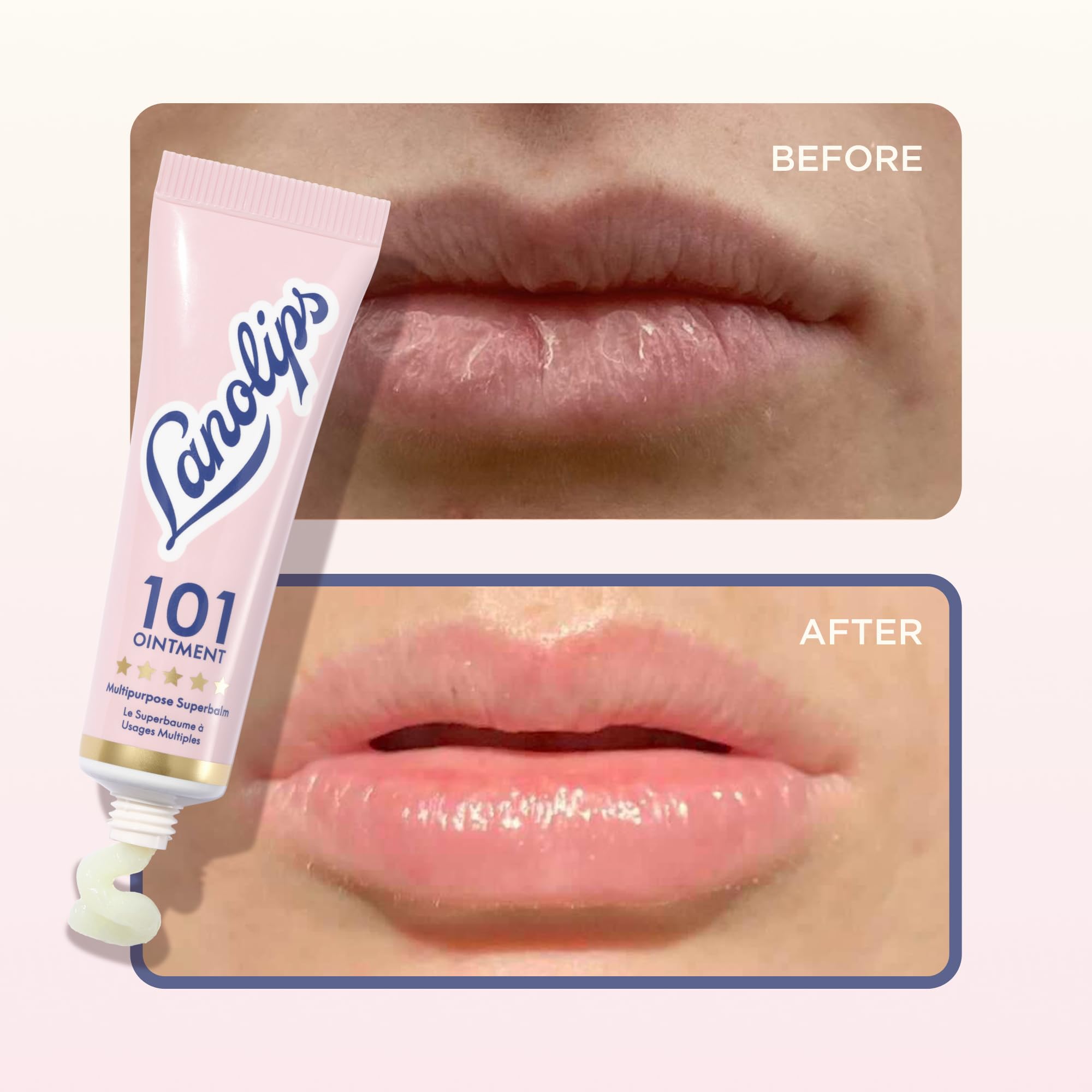Lanolin 101 Multipurpose Ointment - Lanolin Lip Balm & Healing Ointment for Skin Barrier Repair - Moisturizer for Dry Lips, Cuticles & Elbows - No Petroleum Formula - Original Superbalm (0.52 oz) - TrustMedUSA