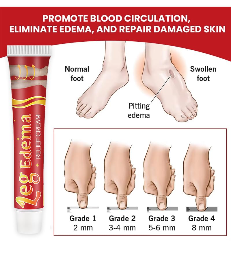 Leg Slimming Massage Cream | Soothing Swelling, Tightening Skin, Auxiliary Care for Reducing Edema （2 Pieces） - TrustMedUSA