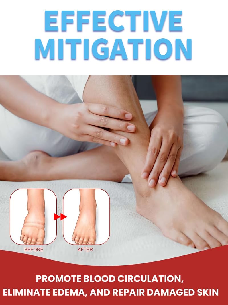 Leg Slimming Massage Cream | Soothing Swelling, Tightening Skin, Auxiliary Care for Reducing Edema （2 Pieces） - TrustMedUSA