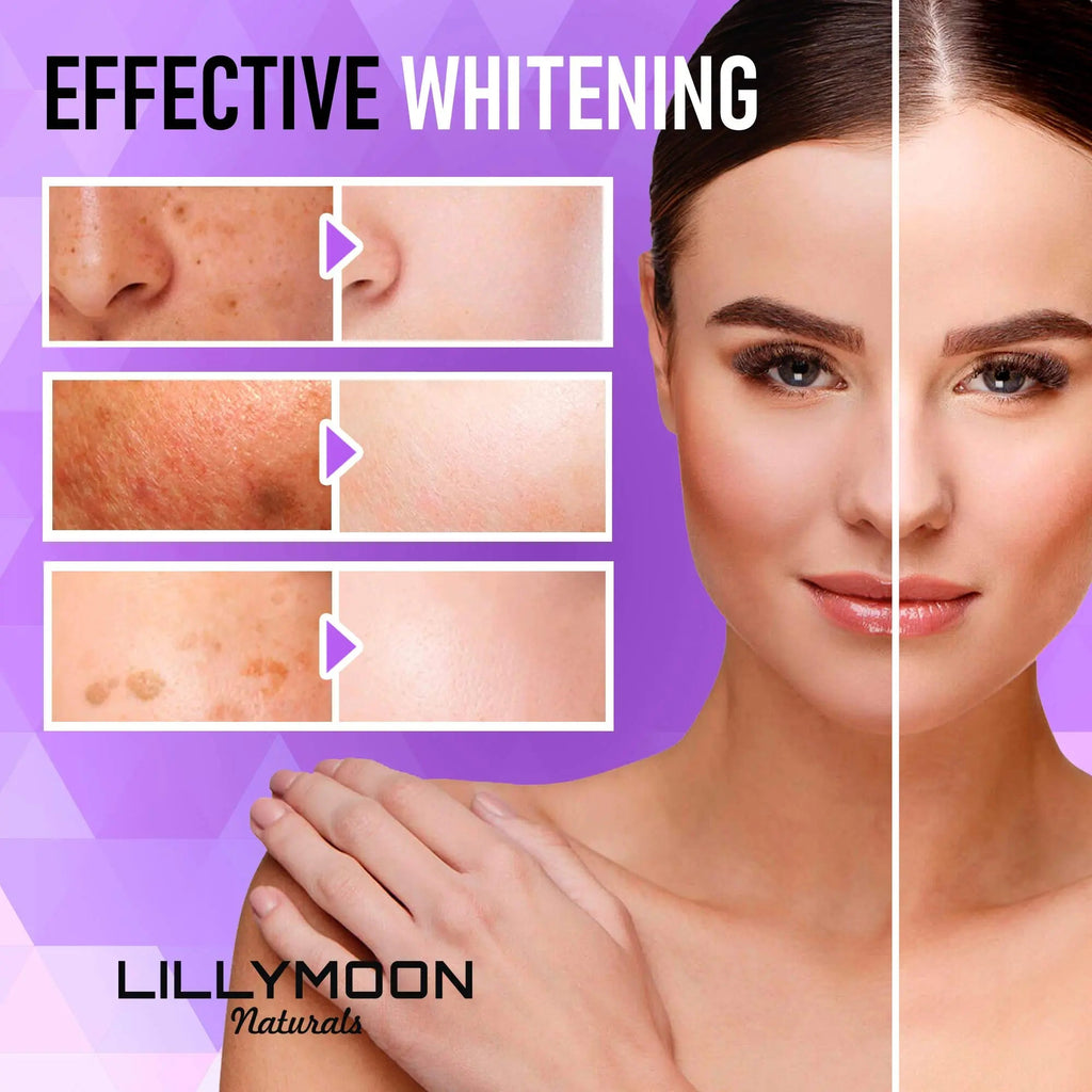 LILYMOON Glutathione Whitening Pills Skin Lightening Pills - Skin Whitening Formula - TrustMedUSA