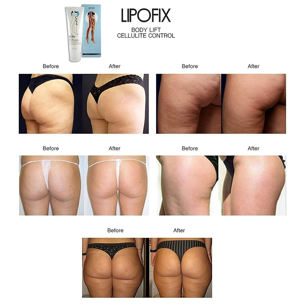 LIPOFIX Anti Cellulite Cream Luxurious Formula Body Contour Cream Effectively Tone - TrustMedUSA