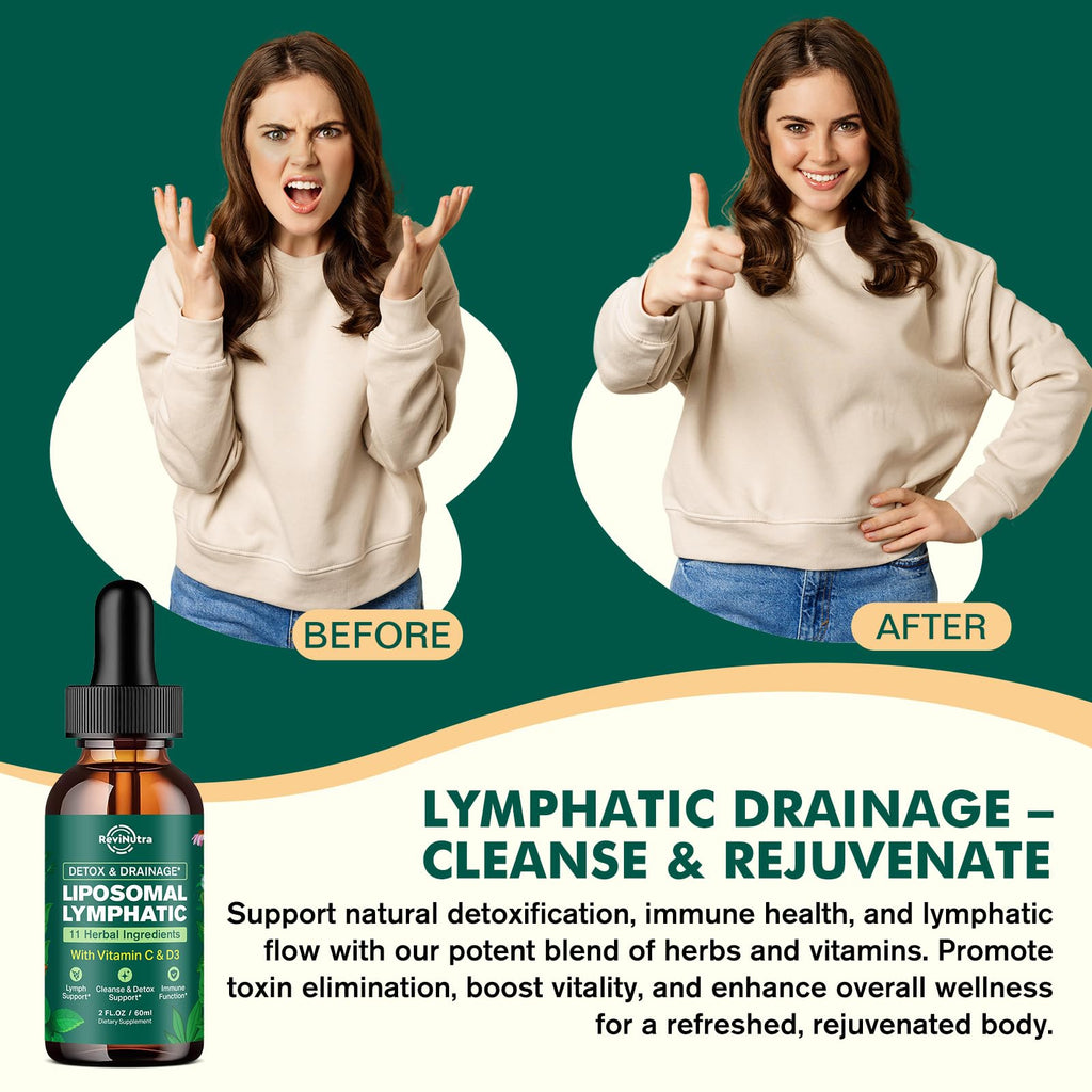 Liposomal Lymphatic Drainage Liquid Drops - Lymphatic Support Supplement with Dandelion Root, Cleavers, Echinacea, Calendula for Immune, Detox Cleanse, Lymph System Support, Lemon Flavor, 2 Fl Oz - Maple Wellness Supplements