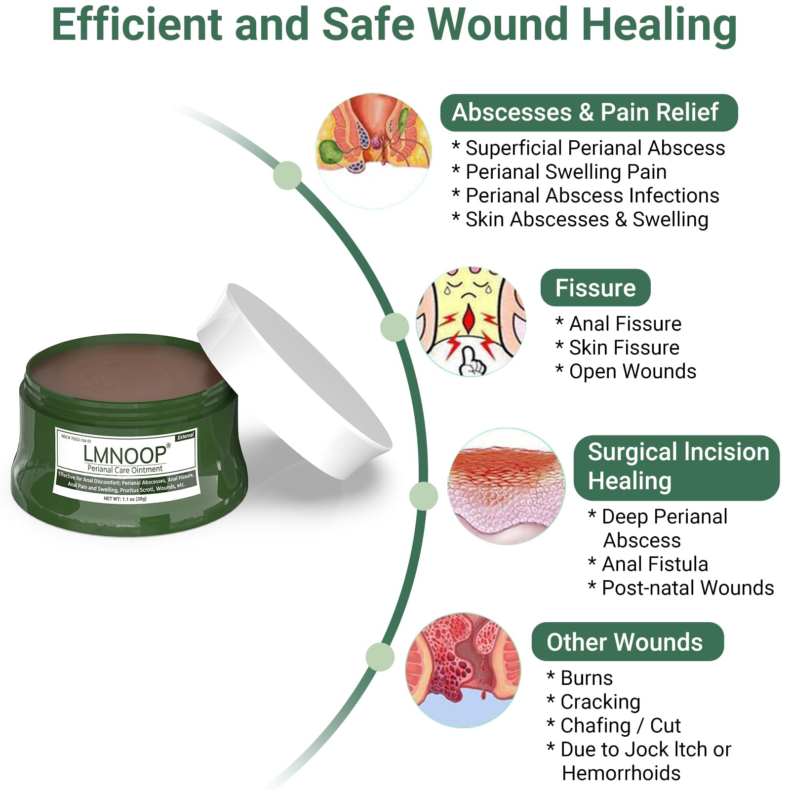 LMNOOP Perianal Repair Ointment: Treatments for Anal Fistula, Anal Fissure, Perianal Abscess, Rapid Relief from Pain, Burning, Itching, Swelling, Bleeding, and Discomfort by Jock Itch or Hemorrhoids - TrustMedUSA