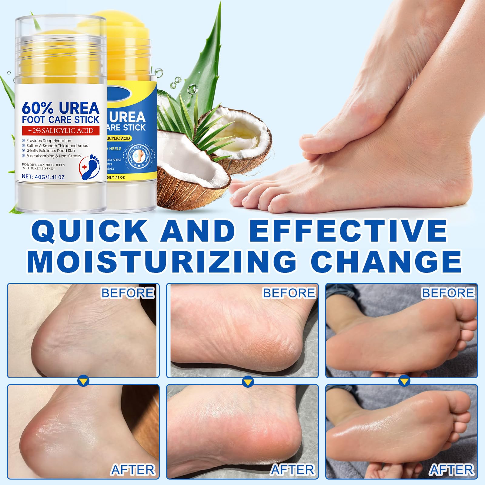 Loobexery 2 Pcs 60% Urea with 2% Salicylic Acid Foot Care Stick, Urea Foot Cream for Cracked Feet, Repairs Dry Rough Heels Fast, Foot Lotion Moisturizer for Dead Skin, Hydrating Heel Balm - Maple Wellness Supplements