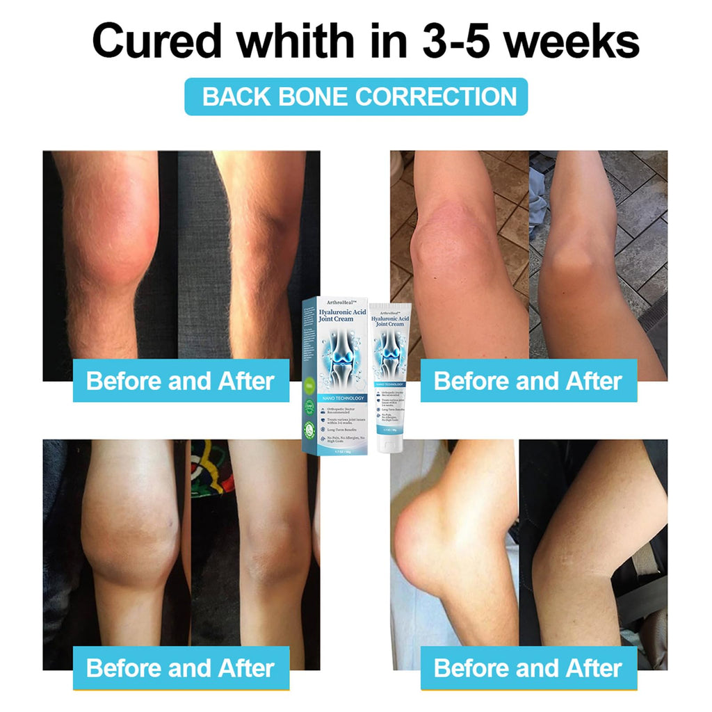 Luhaka ArthroHeal Hyaluronic Acid Joint R-epair Cream,ArthroHeal Joint Cream,Quickly relieve joint discomfort, Quickly relieve joint discomfort, suitable for joint activities throughout the body (1) - TrustMedUSA