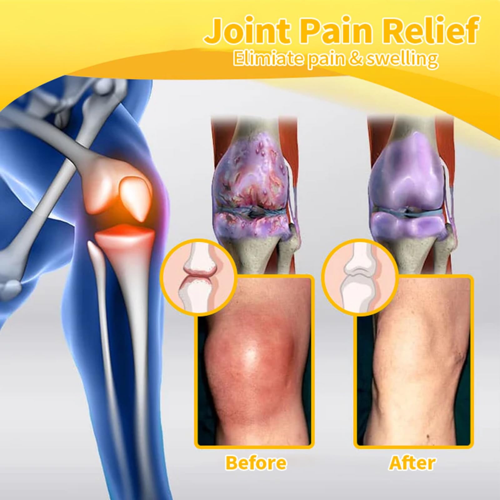 Luhaka Botulinum Toxin & Bee Venom Pain-Relief Bone Healing Cream,Bee Venom Cream,Effectively improve joint mobility (1PC) - TrustMedUSA